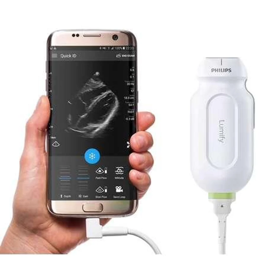 Мобильная ультразвуковая система Philips Lumify