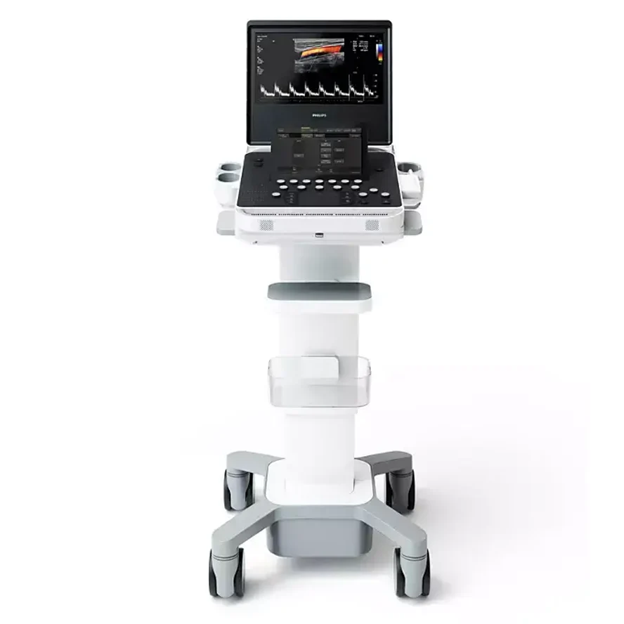Портативная компактная ультразвуковая система Philips 5500